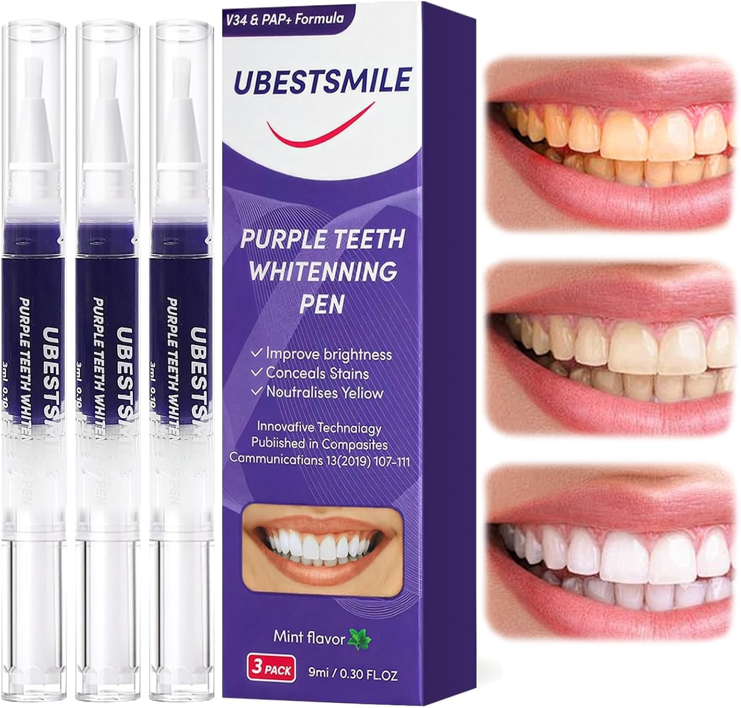 UBESTSMILE V34&PAP+ フォーミュラ パープ - Teeth Whitening Pens のレビューと価格